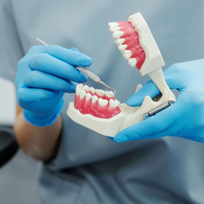 zahnreinigugn schwangerschaft